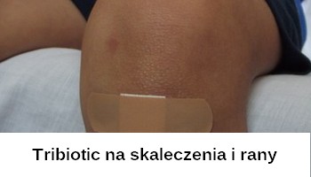 https://www.aleleki.pl/produkt/2801-tribiotic-masc-14-g.html